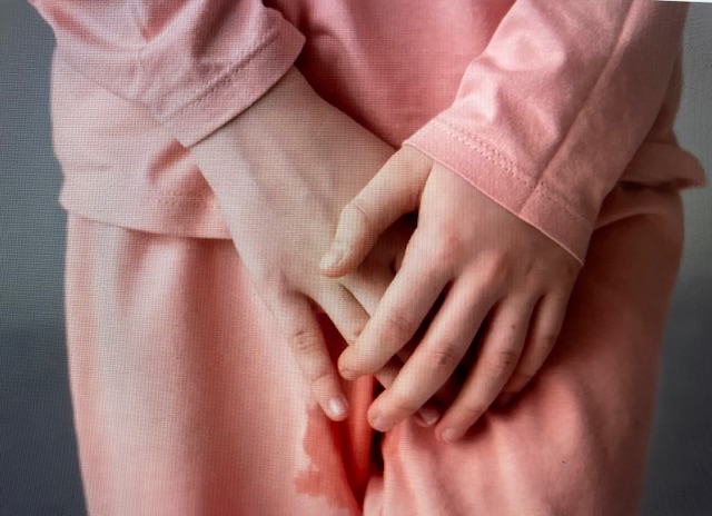 urinary-incontinence
